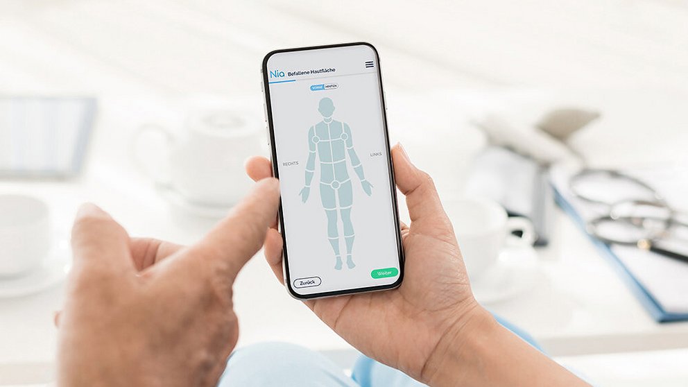 Hand hält Smartphone mit App zur Selbstuntersuchung der Haut, zeigt schematische menschliche Figur mit markierten Körperbereichen