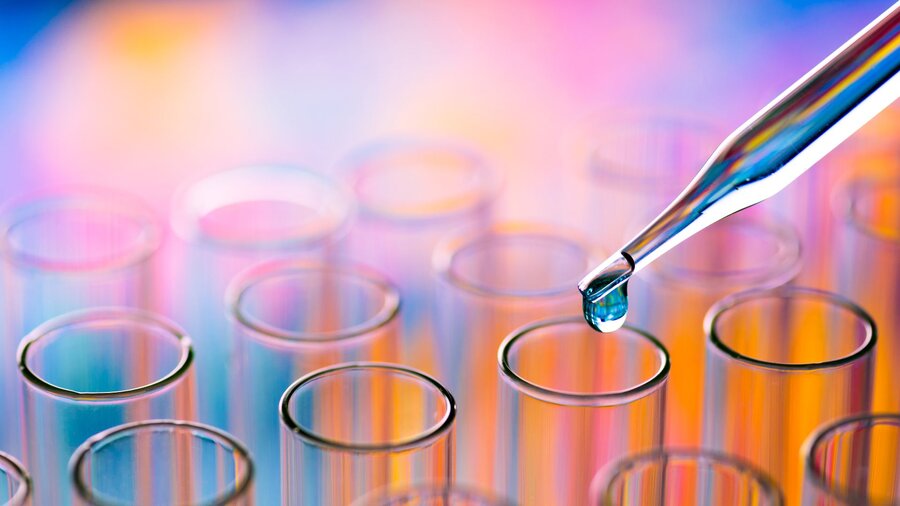 Zu sehen sind viele Reagenzgläser und eine Pipette, die einen Tropfen in eines der Gläser fallen lässt.